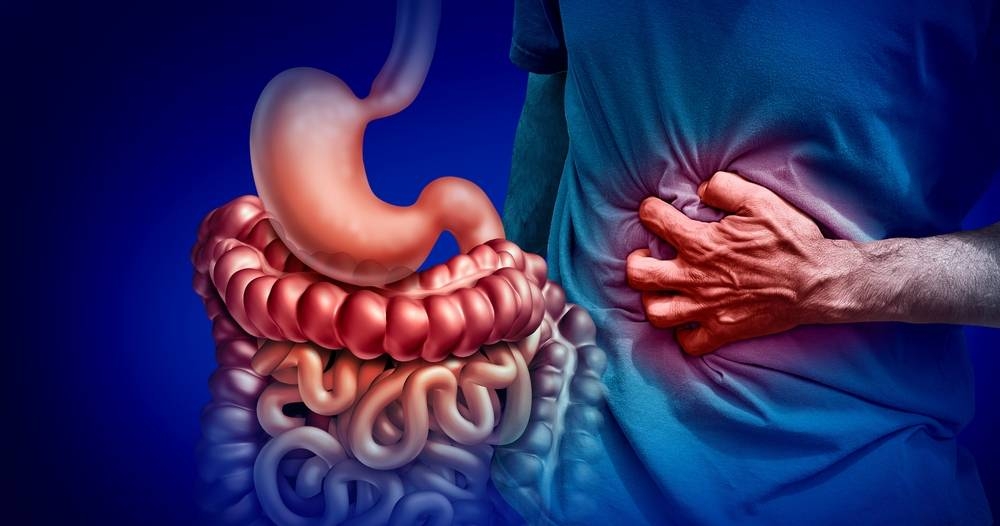 مرض كرون.. التحديات والعلاج في مواجهة اضطرابات الأمعاء المزمنة